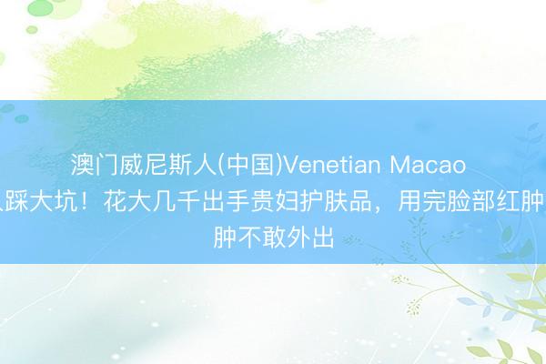 澳门威尼斯人(中国)Venetian Macao 苏醒夫人踩大坑！花大几千出手贵妇护肤品，用完脸部红肿不敢外出